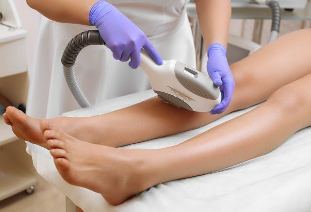 Laser epilation leg Hair removal